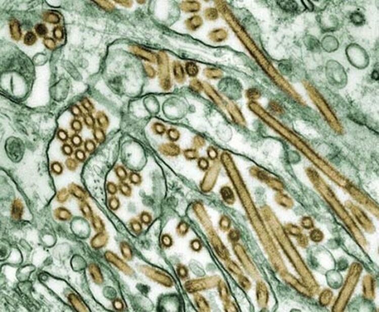 Как выглядят смертельно опасные вирусы под микроскопом