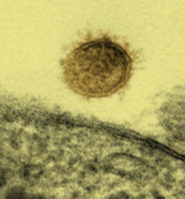 Как выглядят смертельно опасные вирусы под микроскопом